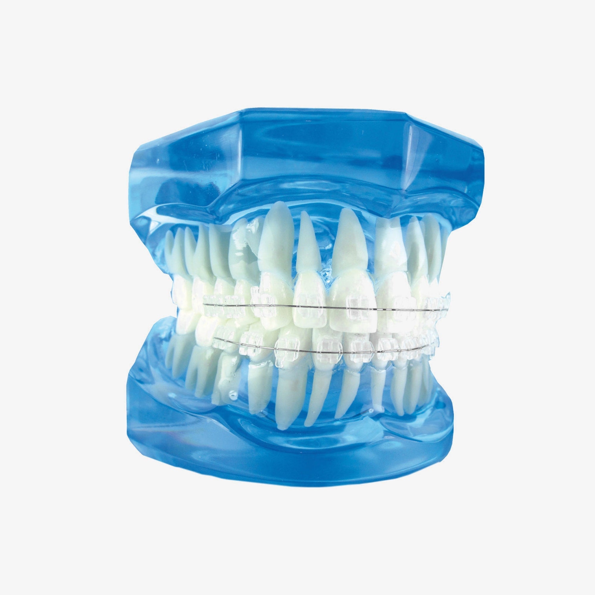 Why Your Choice of Bracket Material Matters. Insights into Aesthetic Orthodontics